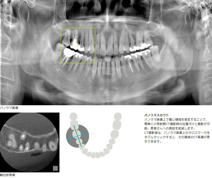 モリタ Veraview X800