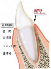 歯周病
