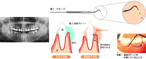 基本検査